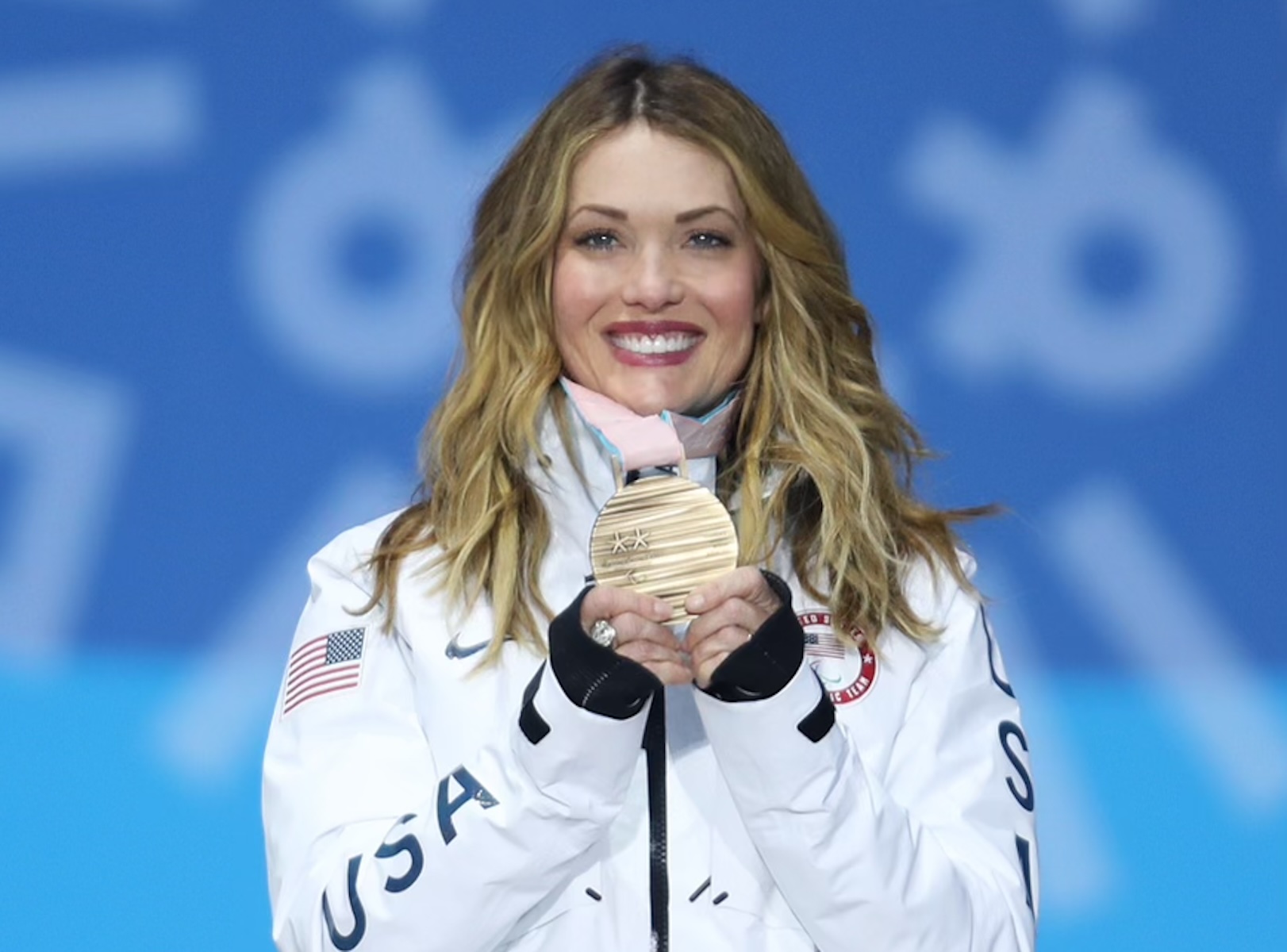 amy purdy